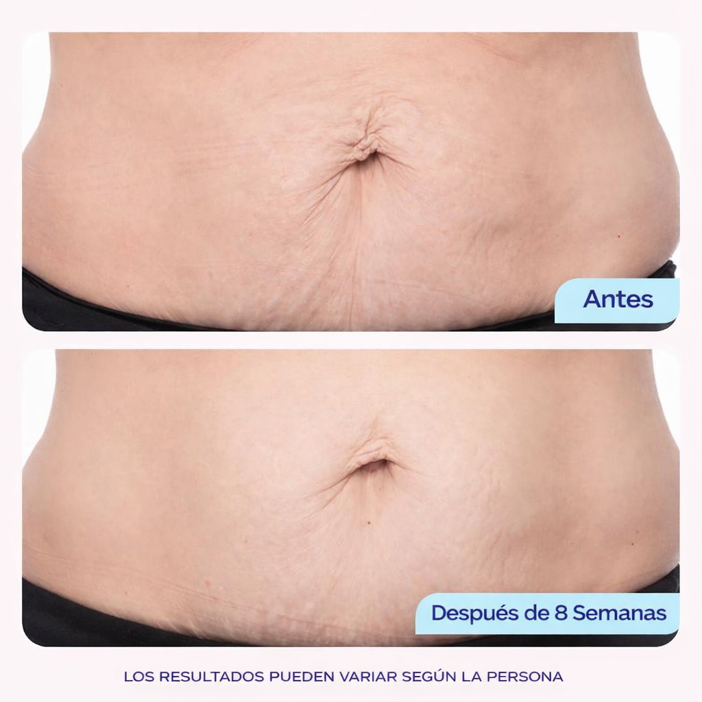 Silke® Crema Reafirmante para Abdomen